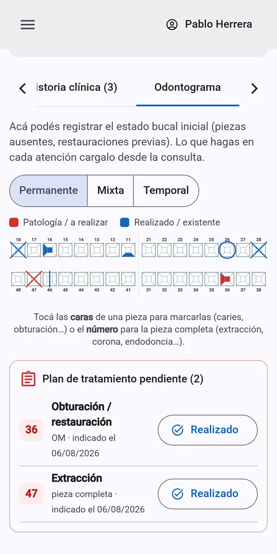 Odontograma con piezas marcadas y plan de tratamiento